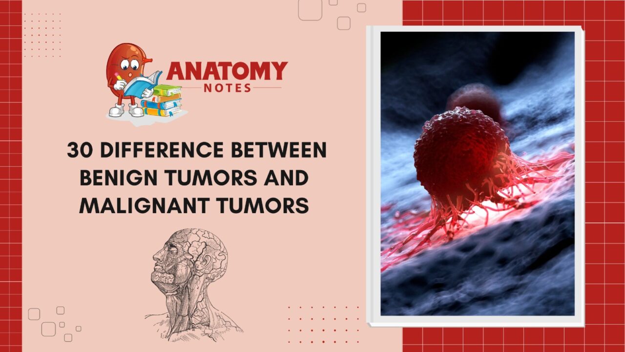 30 Difference Between Benign Tumors And Malignant Tumors