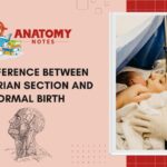 Caesarian Section and Normal Birth