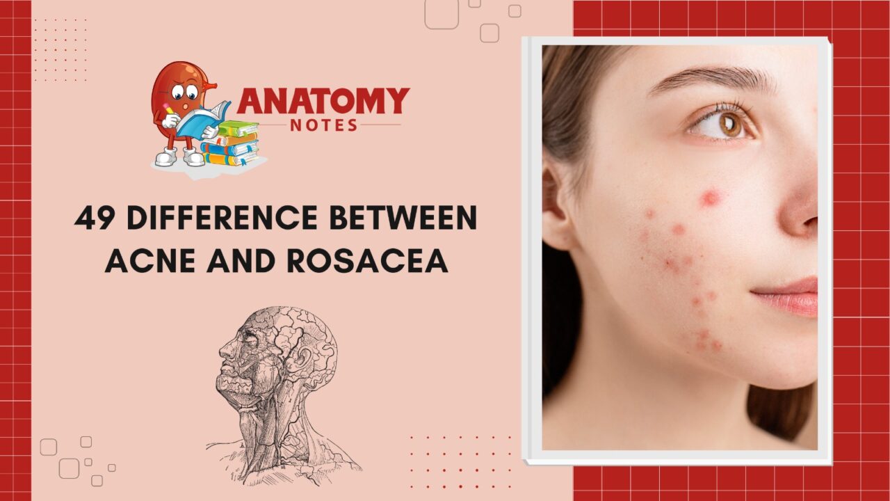 Acne and Rosacea
