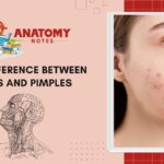 32 Difference between Zits and Pimples