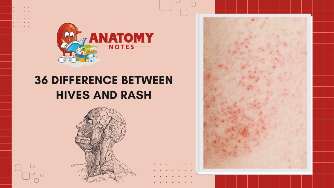 36 Difference Between Hives And Rash