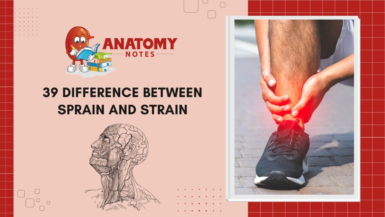 39 Difference Between Sprain And Strain Anatomy Notes 9678