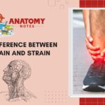 39 Difference Between Sprain and Strain