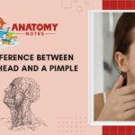 36 Difference Between Blackhead and a Pimple