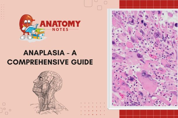 Anaplasia - A Comprehensive Guide